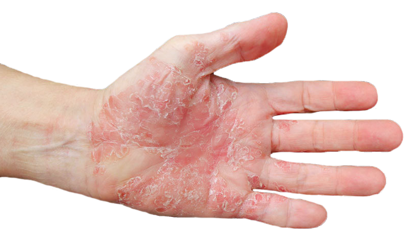 Cuidado dermatológico natural